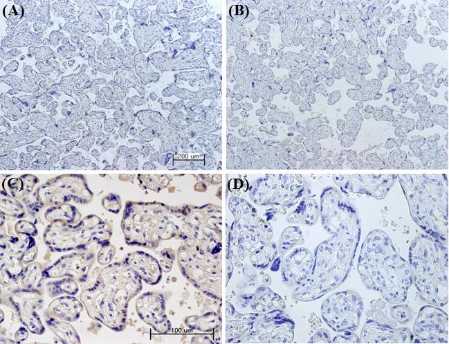 대한산부회지제 51 권제 11 호, 2008 Fig. 3. Immunohistochemical staining of MMP-2 in normal and preeclamptic placentas. MMP-2 was expressed in normal and preeclamptic placental tissues.