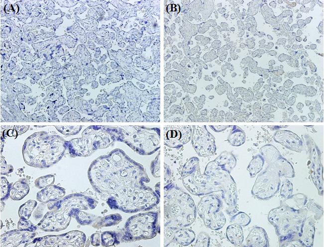 A, C: placentas from normal pregnancies, B, D: placentas from preeclamptic pregnancies. A, B: 100, C, D: 400. Fig. 4. Immunohistochemical staining of MMP-9 in normal and preeclamptic placentas.