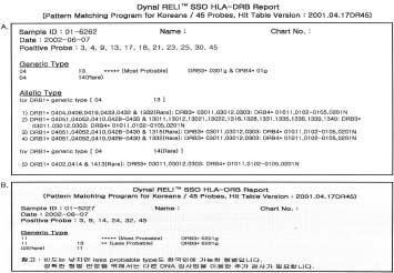 272 송은영 박성근 김선미외 4 인 Table 5. NMDP codes in ambiguous patterns (51 patterns) of the Dynal RELI TM HLA-DRB test (36 probe interpretation software) DRB gene Codes* HLA alleles Fig. 1.