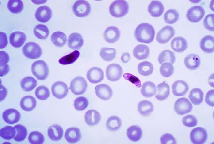 [ 그림 17-23 말라리아를일으키는 Plasmodium falciparum의적혈구감염모습 ] 출처 : https://upload.wikimedia.org/wikipedia/commons/f/fc/plasmodium_falcipar um_01.png) C [ 그림 17-24 파동편모충류 ].