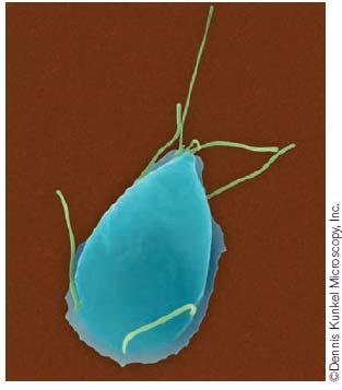 [ 그림 17-25 중복편모충류 (diplomonads) 에속하는장내기생충인 Giardia intestinalis (G. lamblia) 의 SEM 사진 ] Giardia의영양체는장표피에부착함. ( 출처 : http://www.