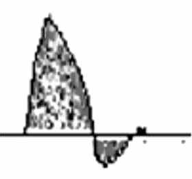 100 대한혈관외과학회지 : 제 23 권제 2 호 2007 왔으며 ABI, Segemental pressure test, Pulse volume recording, Arterial waveform