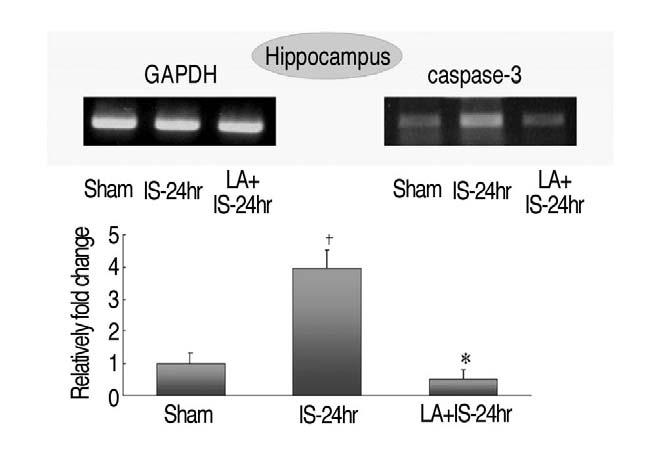 안훈철외 : 흰쥐해마에서일과성전뇌허혈 - 재순환손상후세포고사에대한 α-lipoic Acid 의효과 / 139 생리식염수투여군과비교하여유의하게감소하였다 (p <0.01)(Fig. 3). 4.