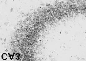 1)(figure 1B). KA에의한발작후 cytochrome c 의세포질내전위와 minocycline의효과 KA 처치후 1시간과 4시간째에 cytochrome c의세포질내전이를관찰하였다.