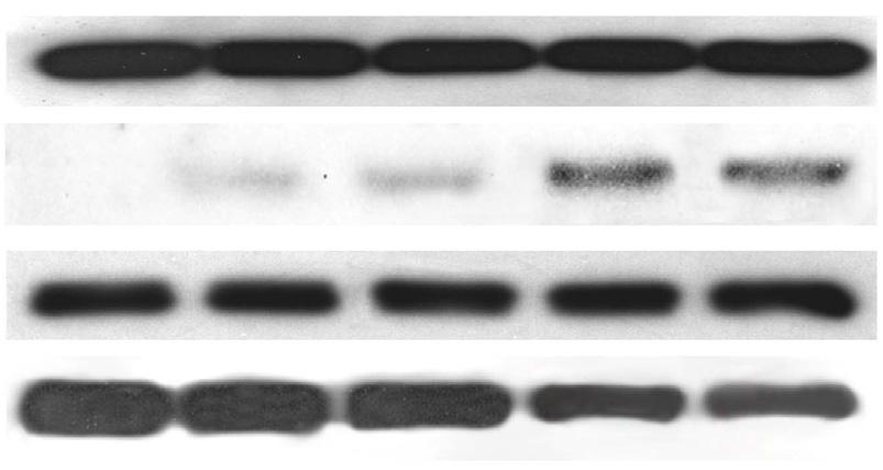 신하영 조양제 조경주등 Cytochrome c에대한면역조직화학염색을 KA 처치후 4시간째에시행하였다. KA를처치하지않은정상대조군에비하여, KA유발발작후 vehicle을투여한군에서해마신경세포질내에 cytochrome c에대한면역반응 (green color) 이뚜렷이증가되었다.