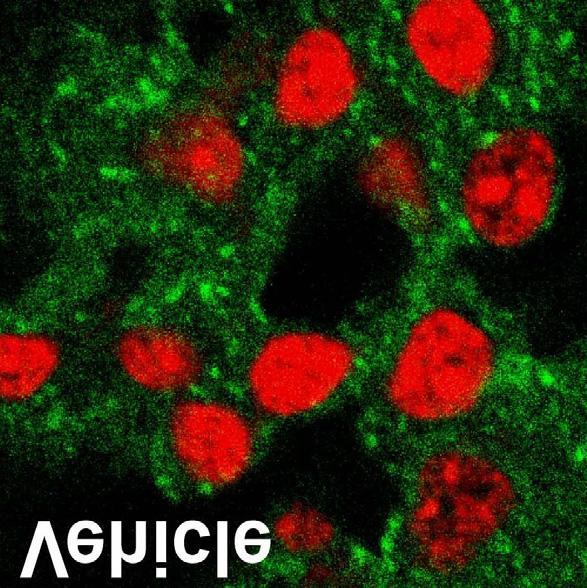 KA 처치후 4시간, 24시간째에 cleaved caspase-3 에대한 Western blot 분석을시행하였으며, 17 kda과 19 kda에해당하는부분에서 cleaved caspase-3에대한면역반응이두개의띠로관찰되었다.