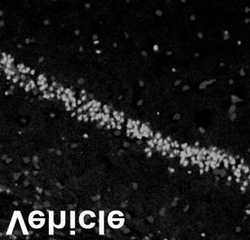 KA 유발간질모델에서 의세포보호효과 4, CAl TUNEL-positive cells/mm 2 3, 2, 1, A CA3 CA1 CA3 Hippocampal subfields 1 Cleaved caspase-3