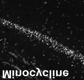 A: Immunofluorescent TUNEL staining and its semi-quantitative analysis showed that TUNEL-positive cells in both CA1 and CA3