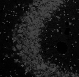 B: In Western blot analysis, the amount of cleaved caspase-3 was significantly reduced in minocycline-treated mice, compared