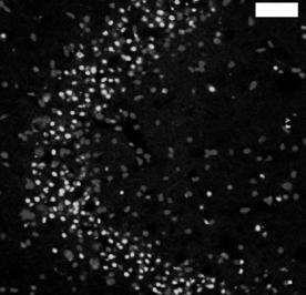 군에서 caspase-3 activity assay를시행하였는데, vehicle 투여군에비해 z-vad.