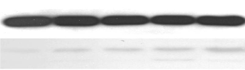 69 ; minocycline, 41.65±3.34 ; t-test, p<.1). 하지만 z-vad.fmk 투여군과 minocycline 투여군사이에는 caspase-3 활성도의차이가없었다 (p=.96)(figure 3C).