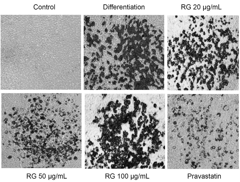 914 정하진 오승택 류천봉 최유라 이성미 전송희 A B Fig. 2. Oil Red O staining in 3T3-L1 adipocytes.