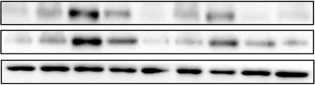 916 정하진 오승택 류천봉 최유라 이성미 전송희 A Sham RG-L RG-M RG-H Pravastatin pampk tampk β-actin B ** C Fig. 5. Expression and phosphorylation levels of AMPK.