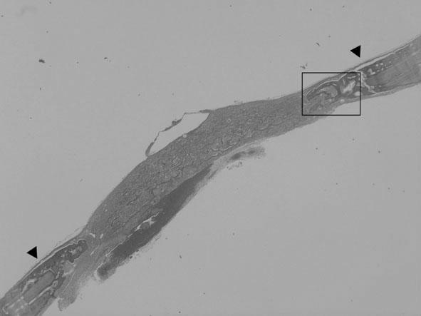 Figure 10. 0.10mg/ml TAT-HA2-BMP-2 2weeks( 20, H-E) Figure 11. 0.10mg/ml TAT-HA2-BMP-2 2weeks( 100, H-E) Active bone formation was observed at the defect margin.