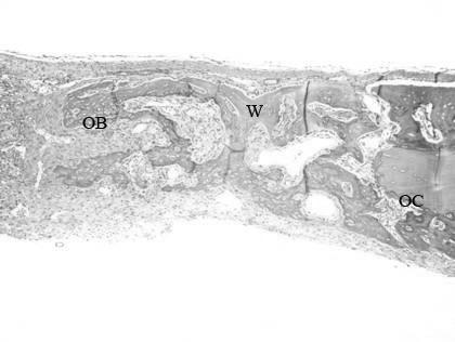 W: woven bone, OC: osteoclast, OB: osteoblast( 100, H-E) Figure 12. 0.10mg/ml TAT-HA2-BMP-2 8weeks( 20, H-E) Figure 13. 0.10mg/ml TAT-HA2-BMP-2 8weeks( 100, H-E) Bone defect was almost filled with new bone.