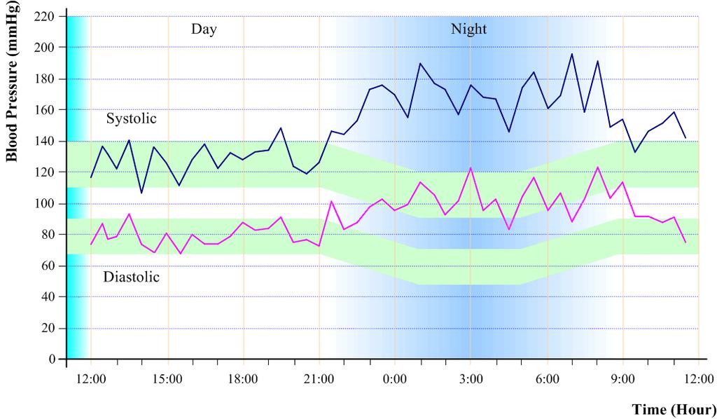 Non-Dipper Systolic &