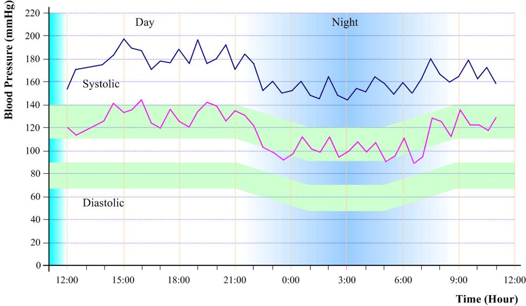 Night-Time Drop Systolic &