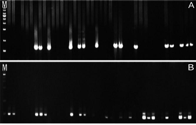 (Fig. 4-6, Table 5). 5. 변수간상관분석 Fig. 3. Representative results from the electrophoresis of polymerase chain reaction using Streptococcus mutans and Streptococcus sobrinus in saliva samples of group 3.