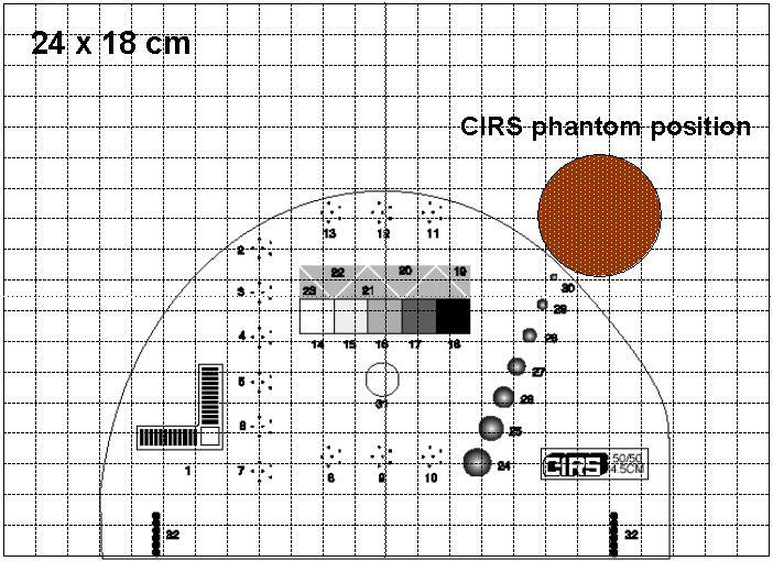 방법에서제시한위치에서 CIRS-012 phantom ESE 값을계산하였다. 그림 7.