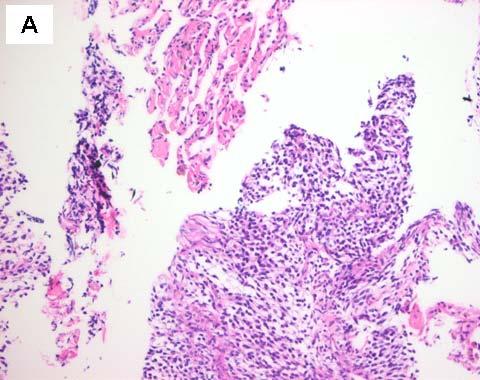 Tuberculosis and Respiratory Diseases Vol. 62. No.2, Feb. 2007 Figure 6.