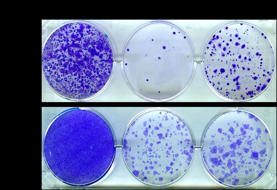 pancreatic cancer cell lines.