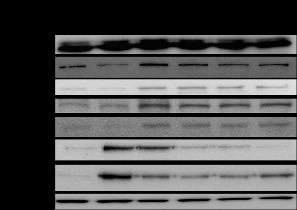 with one shrna and examined by western blotting after recombinant TGFβ1 treatment.