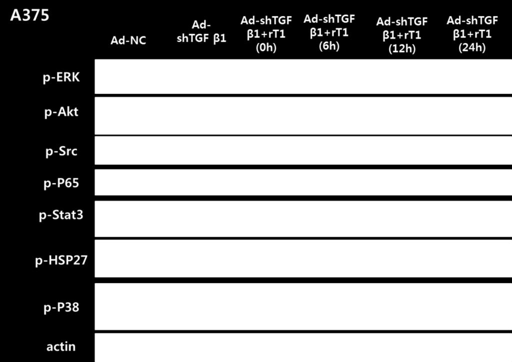 recombinant TGFβ1 protein (Figure 3A).