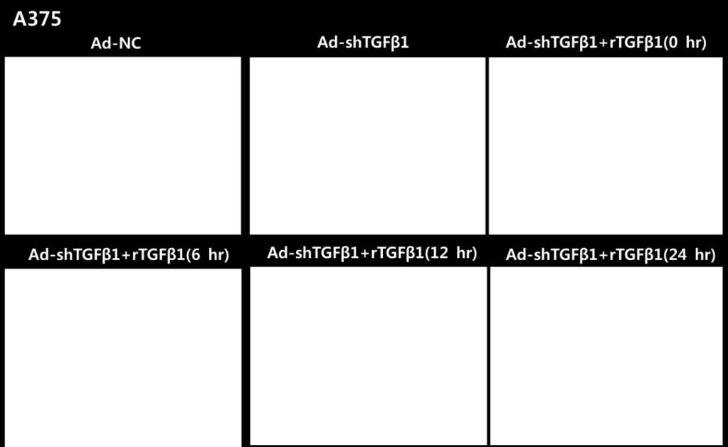 After 48 hr, the expression of p-p38, p-akt, p-hsp27, p-erk, p-src, p-p65, p-stat3 and GAPDH were detected via western blot analysis.