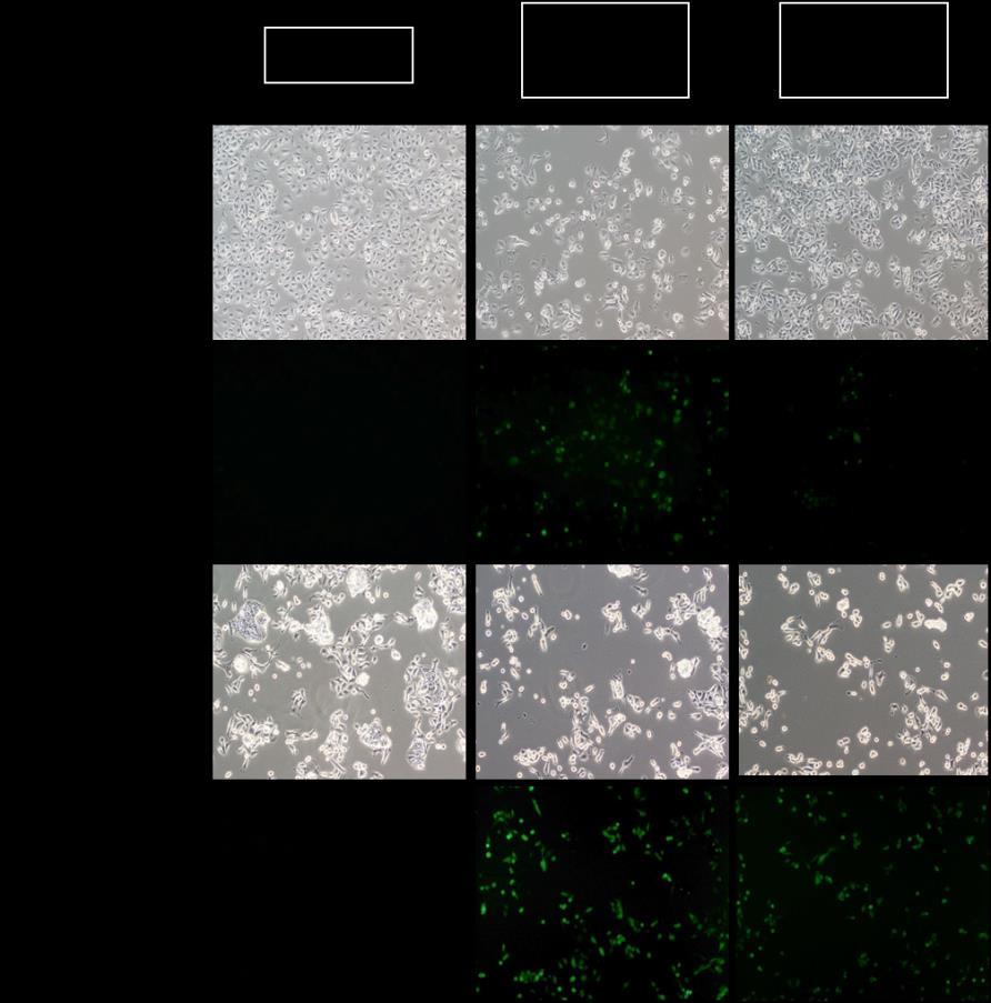 ROS has been reported to be related to JNK and p38 pathways in many studies.