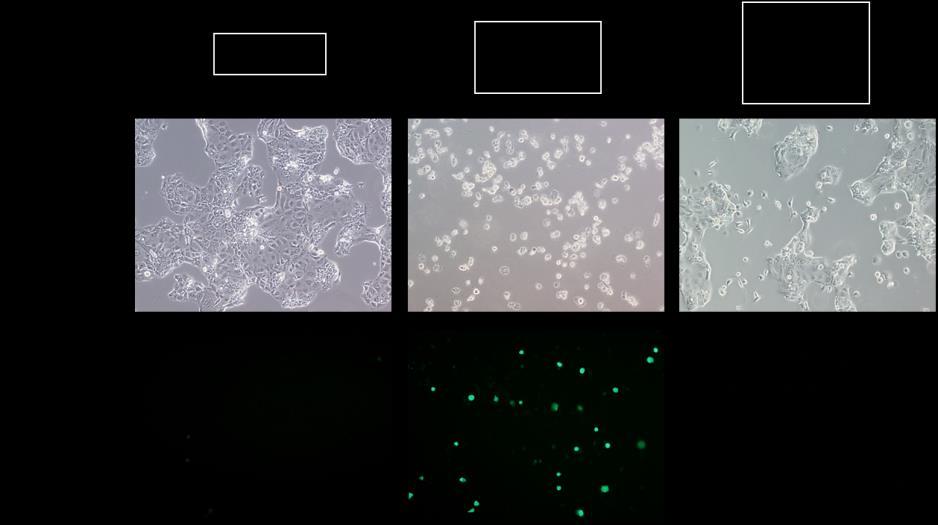 the ROS production was significantly reduced by NAC treatment, however the cell death still remained(figure