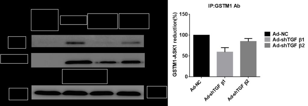 After 48 hr, the expression of p-ask1, ASK1, Trx, GSTM1 and GAPDH were detected by western blot analysis.