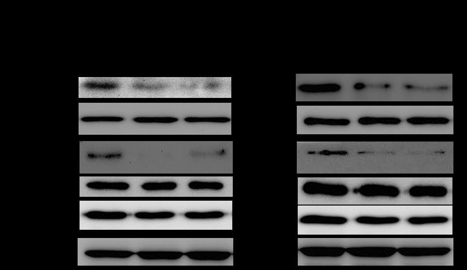 (C) (D) Figure 7. Regulation of Trx, GSTM1 promoter activity by TGFβ.