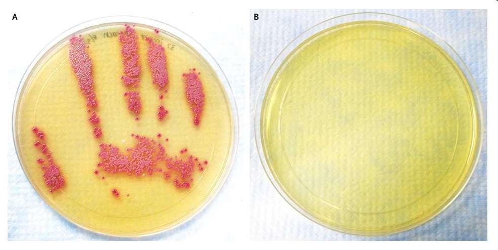 적절한손위생의효과 MRSA 가집락화된환자의복부진찰후, handprint 에서자란 MRSA colony (MRSA 선택배지사용