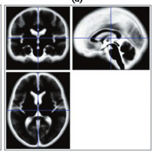 5a에서보여준 3차원 T1 표준영상을 2차원횡단면뇌표준판 (transverse brain template) 으로다시보여준영상이다. 시야는 157 189 156 mm로 MNI152 표준판의시야 182 218 182 mm와비교할때매우높은신호와해상도를보여주고있다. Fig.