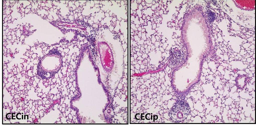 of administration route of CEC: intraperitoneal or intranasal injection.