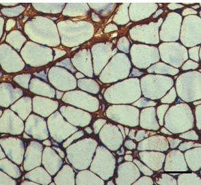 interstitial connective tissue.