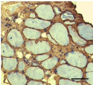 distributed collagen VI both in interstitium and sarcolemma.