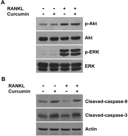 Effect of curcumin on osteoclast apoptosis. Mature osteoclasts from co-culture were plated on 48-well plates and cultured for 4 h.