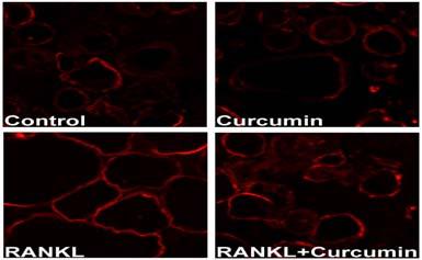 먼저우리는파골세포의액틴고리형성에 curcumin의효과를검증하였다. 그림 4에서보는것과같이 RANKL을처리한실험군에서는파골세포의액틴고리형성이잘이루어진것을볼수있지만, curcumin을같이처리한실험군은파골세포의액틴고리형성이파괴되는것을볼수있었다 (Fig. 4). Fig. 4. Effect of curcumin on osteoclast actin ring formation.