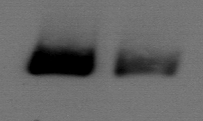 대한류마티스학회지제 17 권제 2 호 2010 로나누어 48시간동안반응시킨후 IL-1β, IL-6, CCL-2, CCL-7, COX-2와 MMP-9의 mrna 감소정도를 RT-PCR 및정량적 real-time PCR을통해확인한결과, 그림 2와같이 TNF-α를투여하지않은경우 rosiglitazone의농도가증가함에비례하여 IL-1β, IL-6, CCL-2,