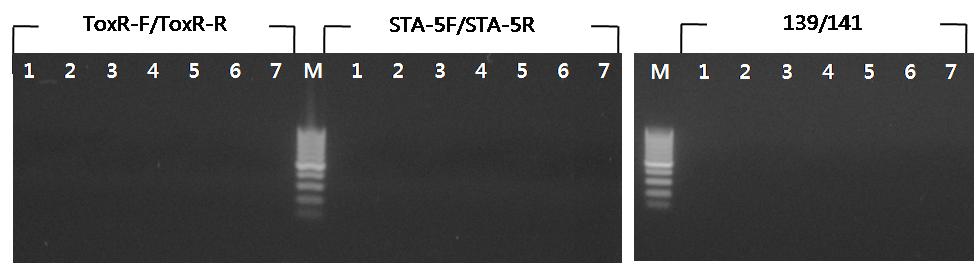 598 정유석 정희경 전원배 서화정 홍주헌 Fig. 3. Agarose gel electrophoresis of PCR fragment generated by PCR amplification with STA5F/STA5R, 139/141, and TOXF/ TOXR primer.