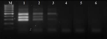 Jeong 등 (18) 은 Salmonella의 PCR 검출시 genomic DNA 1 pg까지검출이가능하다고하였는데본연구에서는세균주모두 single 및 multiplex PCR법에의해 10 pg까지의낮은검출능을나타내었다.