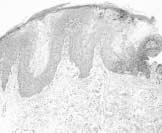 of mandiblular attached gingiva. Fig. 9.