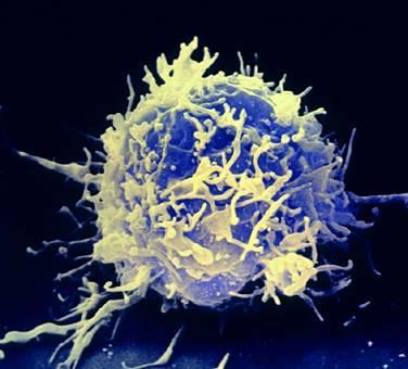 3-1) 세가지의임프구 B 임프구 (B lymphocytes) : 항체의생산 T 임프구 (T lymphocytes) : 흉선 (thymus) 에서성숙 : 면역반응의조절및작용 - helper T cell ( 도와주는 T 임프구 ) -