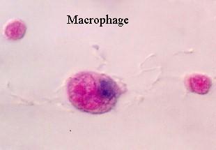 4-1) macrophage 의성숙 혈구줄기세포가골수에서분화성숙 : 주변혈액 (peripheral
