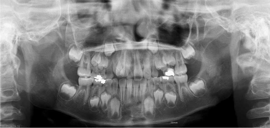 Occlusal view. Fig. 10.