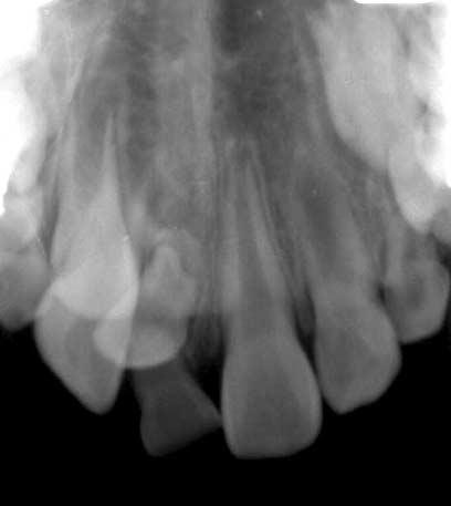 b. Intraoral view. Fig. 11.