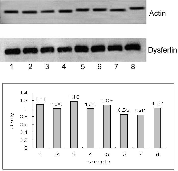Figure 4. Western blotting in normal control groups for dysferlin. Graph shows the relative density of dysferlin in normal control groups. (Average of relative density: 1.01) Figure 5.