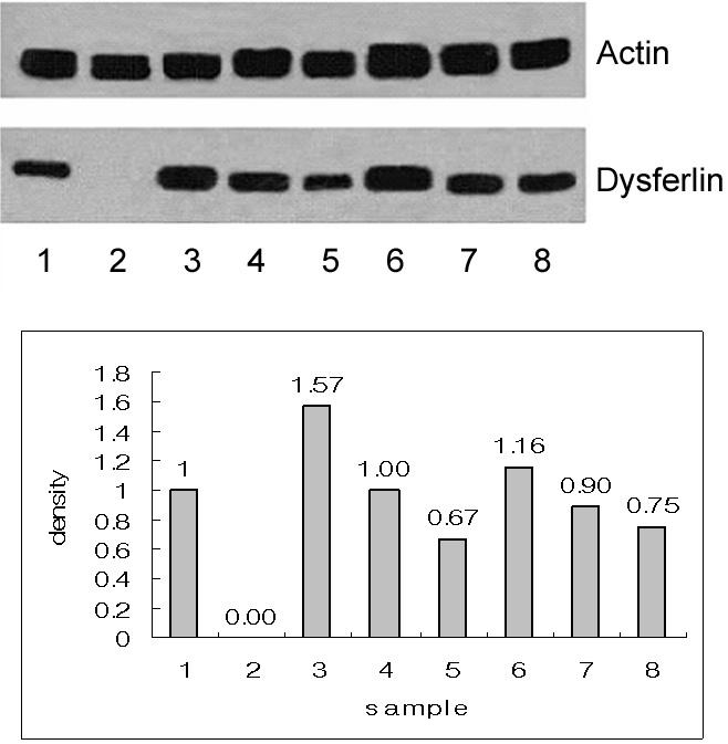 Figure 6. Western blotting in DMD patients for dysferlin. Graph shows the relative density. 1: Normal control, 2: dysferlinopathy, 3-8: DMD. (Average of relative density in DMD: 1.01) Figure 7.