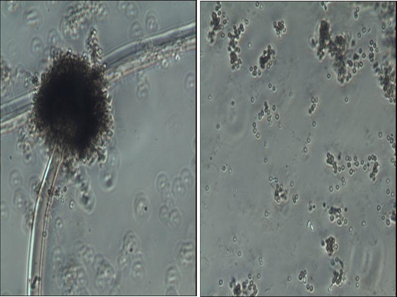 Ⅱ. 연구사업수행내용및결과 : 5. 하등생물 Ampelomyces 속은자낭균문 (Ascomycota), 불완전균강 (Deuteromycetes, mitosporic fungi), 분생자각균목 (Sphaeropsidales) 에속하는균으로서병자각 (pycnidium) 을형성하는균인데 A.